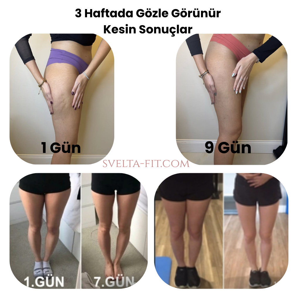 Svelta-Fit Bacak İncelten ve Sıkılaştıran Masaj Aleti